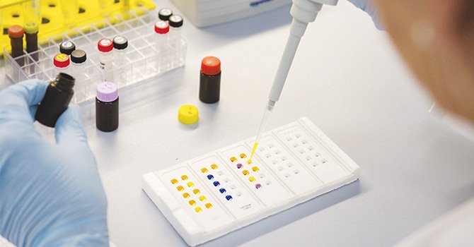 Nuevas recomendaciones para evitar transmisión sexual del zika