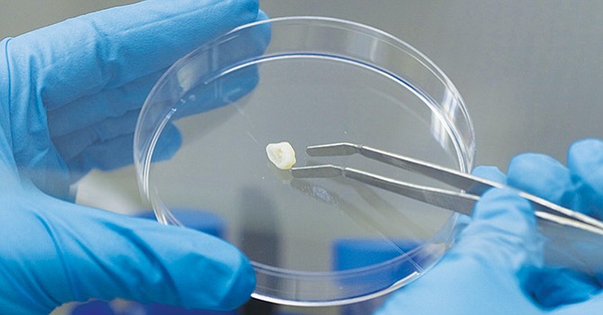 Utilizan células dentales para curar enfermedades y revertir envejecimiento, método innovador de una empresa acumula 20 mil muestras de latinos