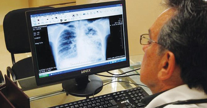 Detectan tuberculosis, autoridades tratan de localizar a quienes pudieron contagiarse en dos preparatorias