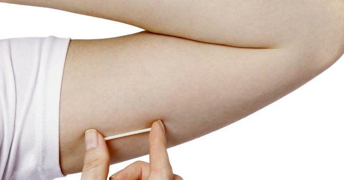 Control natal gratuito ayuda a disminuir abortos