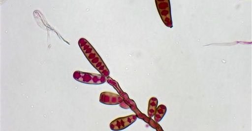 Meningitis por hongos, un misterio científico