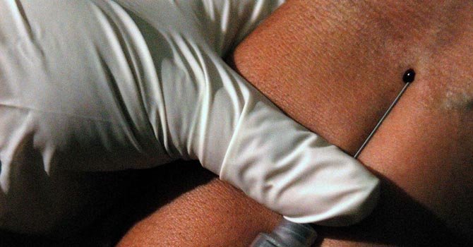 Jóvenes, más afectados por el VIH