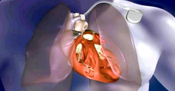 Hormona contra la obesidad protege al corazón