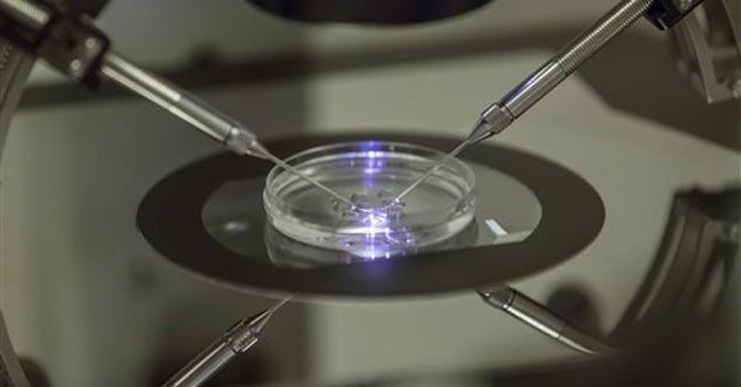 Económica técnica de fertilización in vitro