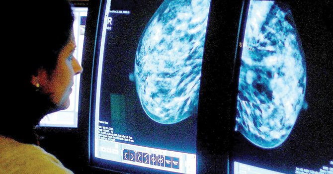 Identifican nuevo gen que dispara el cáncer de seno
