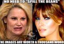 Trump retuiteó un mensaje de uno de sus seguidores con un montaje que comparaba una fotografía poco favorecedora de Heidi Cruz con otra más agradecida de la esposa de Trump y exmodelo, Melania.