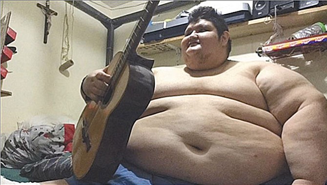 El hombre más obeso del mundo inicia tratamiento