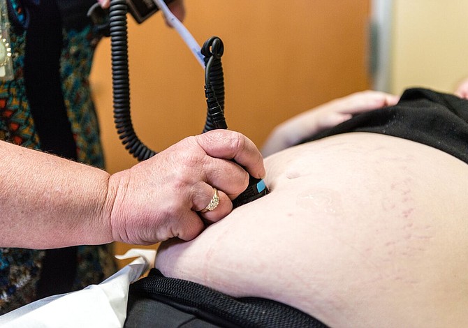 Récord de infecciones sexuales dispara nacimientos de bebés con sífilis
