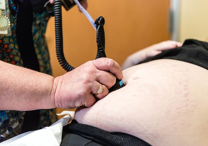 Récord de infecciones sexuales dispara nacimientos de bebés con sífilis