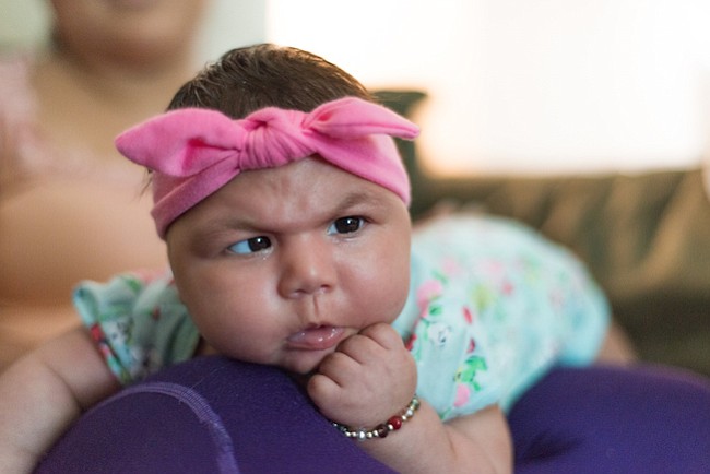 La marca del zika: mamá hispana cuenta el dolor de tener una beba con microcefalia