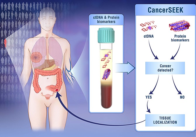 Un solo análisis de sangre para detectar ocho tipos de cáncer