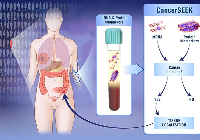 Un solo análisis de sangre para detectar ocho tipos de cáncer