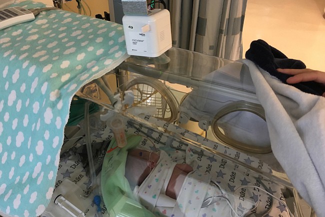 Bebes prematuros: cámaras mantienen a la familia cerca, y a los gérmenes lejos
