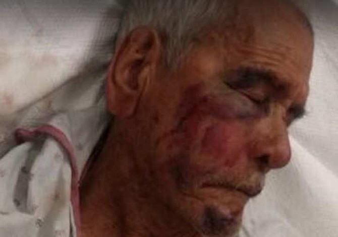 Atacaron con un ladrillo a un mexicano de 92 años en Los Ángeles