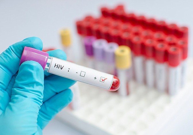 Investigan anticuerpos que neutralizan el virus del sida