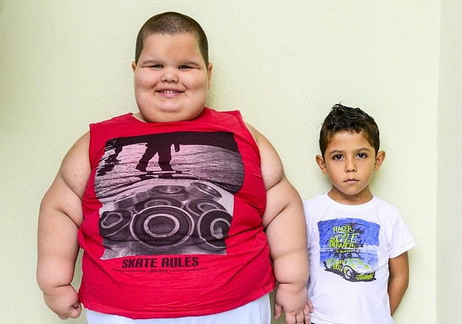 Cirugía bariátrica para niños obesos puede salvar vidas