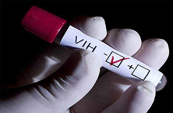 ¿Cuál es la técnica médica para eliminar el VIH?