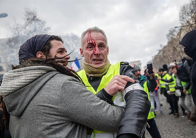 Integrante de "chalecos amarillos" pierde una mano durante protesta en París