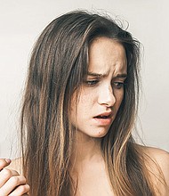 Consumo excesivo de calorías provoca la caída del cabello.