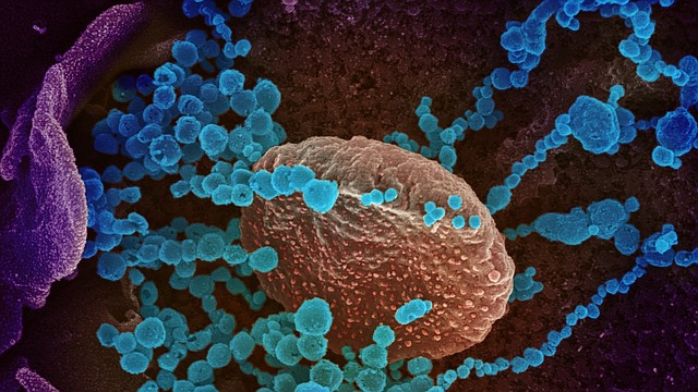 SALUD. Fotografía cedida por el Instituto Nacional de Alergias y Enfermedades Infecciosas y los Laboratorios Rocky Mountain de una imagen de microscopio electrónico que muestra (objetos en azul) al SARS-CoV-2, el virus que causa el brote del coronavirus COVID-19, emergiendo de la superficie de las células cultivadas en el laboratorio. | Foto: Efe.
