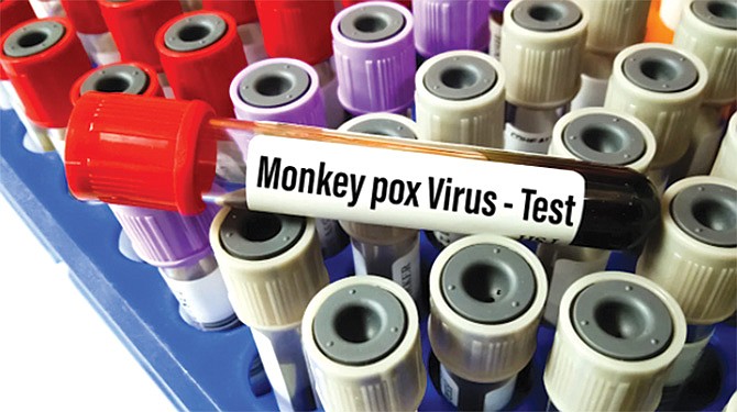 Vacuna contra viruela del mono tarda semanas en inmunizar