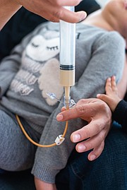 Abril es alimentada a través de un tubo gastrointestinal en su casa en Santa Cruz, California, el 5 de abril de 2017. El niño de ocho años tiene graves daños cerebrales y parálisis cerebral severa y necesita atención las 24 horas.