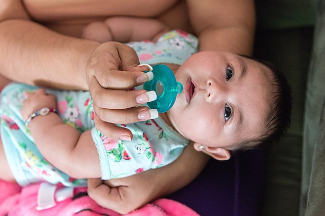 Aryanna nació con la microcefalia inducida por Zika, una condición en la cual la cabeza es más pequeña que la media.