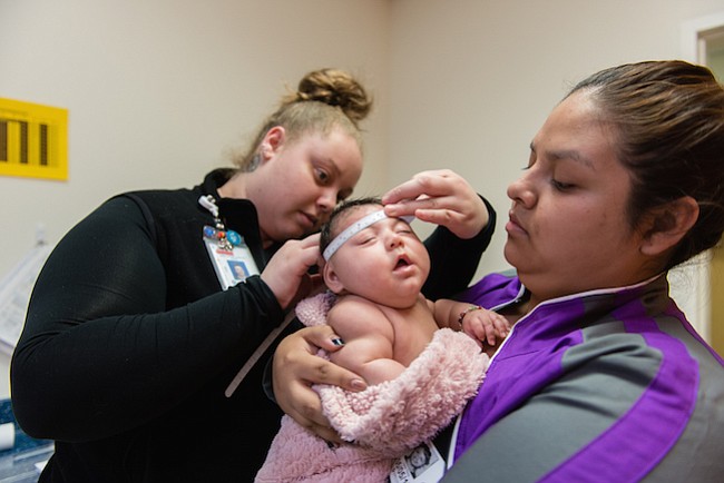 Jessica Rios sostiene a su sobrina Aryanna Guadalupe Sánchez-Ríos mientras un técnico que mide el cráneo del bebé en el Hospital de Niños de Seattle el 5 de mayo de 2017. A los 3 meses de edad, su cabeza era todavía más pequeña que la media.
