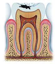 CARIES. Si usted no tiene tiempo suficiente para cepillarse los dientes, se aconseja que se enjuague la boca después de las comidas.