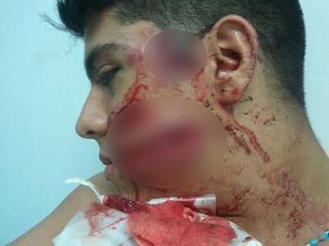 REPRESIÓN. Efectivos de seguridad del régimen de Maduro dispararon cinco perdigones a la cara y tres a la espalda de Vásquez en una protesta en 2013. *Esta foto ha sido publicada con la autorización de la víctima. | Foto cortesía.