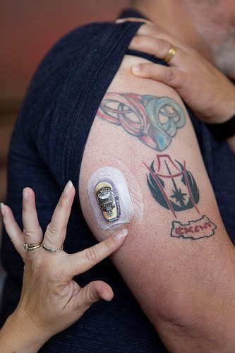En su casa de Whittier, California, Lisa Peralta coloca el sensor Dexcom en el brazo de Ric. Antes de tener este dispositivo, Ric tenía que controlar sus niveles de glucosa pinchándose el dedo varias veces al día y colocar la sangre en una tira plástica. (Allison Zaucha para NPR)