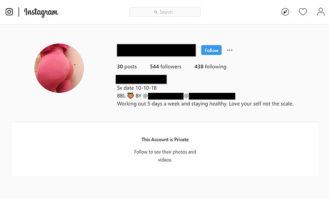 Las “bios” para las “páginas Sx” de Instagram generalmente incluyen detalles como el peso y la altura, la fecha de la cirugía, el tag del cirujano y otros datos. (nota: esta captura de pantalla se editó en Photoshop para cubrir información que identificara a la paciente) (Captura de pantalla tomada por KHN el 28 de agosto de 2019)