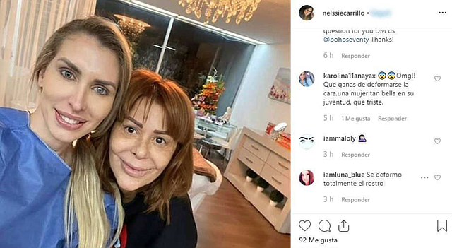 SHOW. Alejandra Guzmán vuelve al quirófano para cambiar la apariencia de su rostro