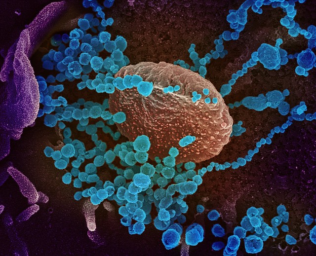 SALUD. Fotografía cedida por el Instituto Nacional de Alergias y Enfermedades Infecciosas y los Laboratorios Rocky Mountain de una imagen de microscopio electrónico que muestra (objetos en azul) al SARS-CoV-2, el virus que causa el brote del coronavirus COVID-19, emergiendo de la superficie de las células cultivadas en el laboratorio. | Foto: Efe.