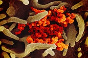 SALUD. Elizabeth Fischer usa un microscopio electrónico para capturar imágenes del coronavirus, que es aproximadamente 10,000 veces más pequeño que el ancho de un cabello humano