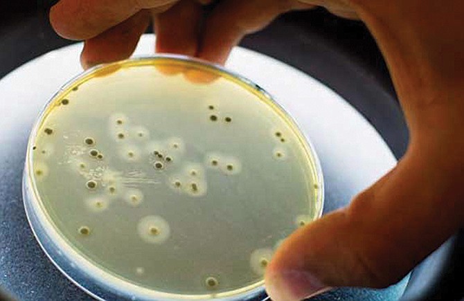 CDC advierte sobre superbacteria estomacal